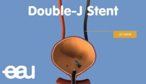 Best Andrology Hospitals in Chennai | Chennai Kidney Care