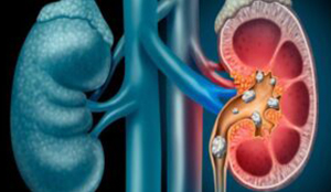 Best Andrology Hospitals in Chennai | Chennai Kidney Care