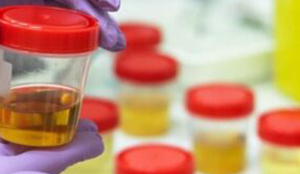 Kidney hospital in Chennai | Dialysis center in Chennai | Chennai Kidney Care