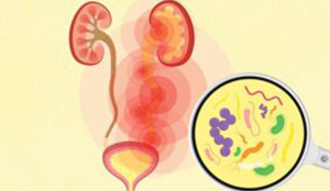 Best Andrology Hospitals in Chennai | Chennai Kidney Care