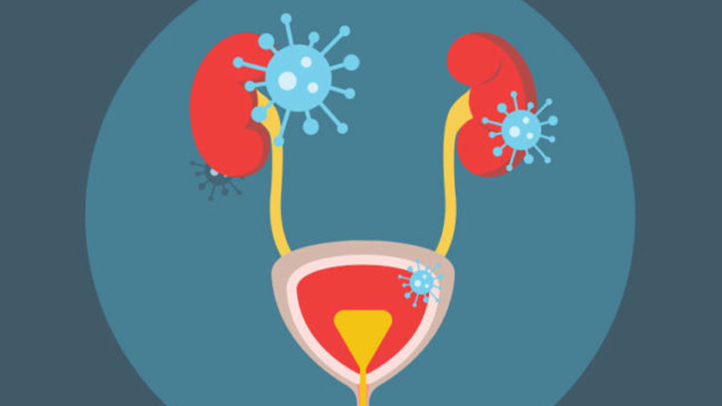 Incontinence surgical treatment in Chennai | Chennai Kidney Care